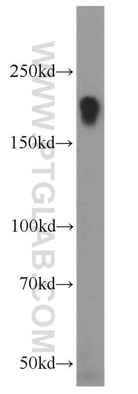 Western Blot (WB) analysis of human skeletal muscle tissue using LIFR Polyclonal antibody (22779-1-AP)