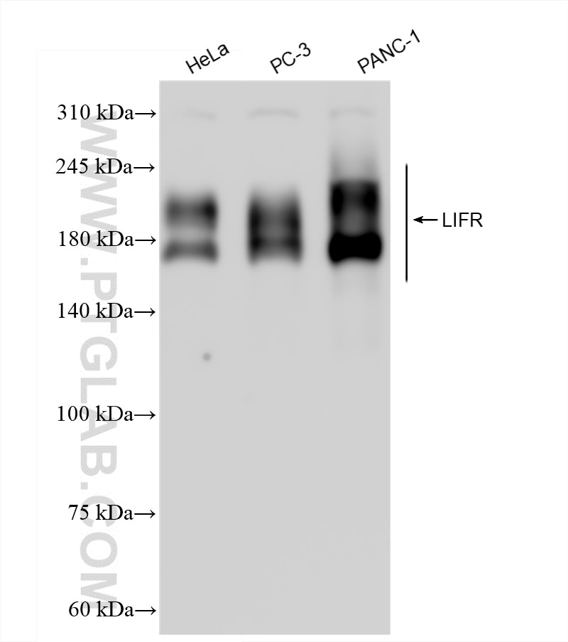 Western Blot (WB) analysis of various lysates using LIFR Recombinant antibody (85827-2-RR)