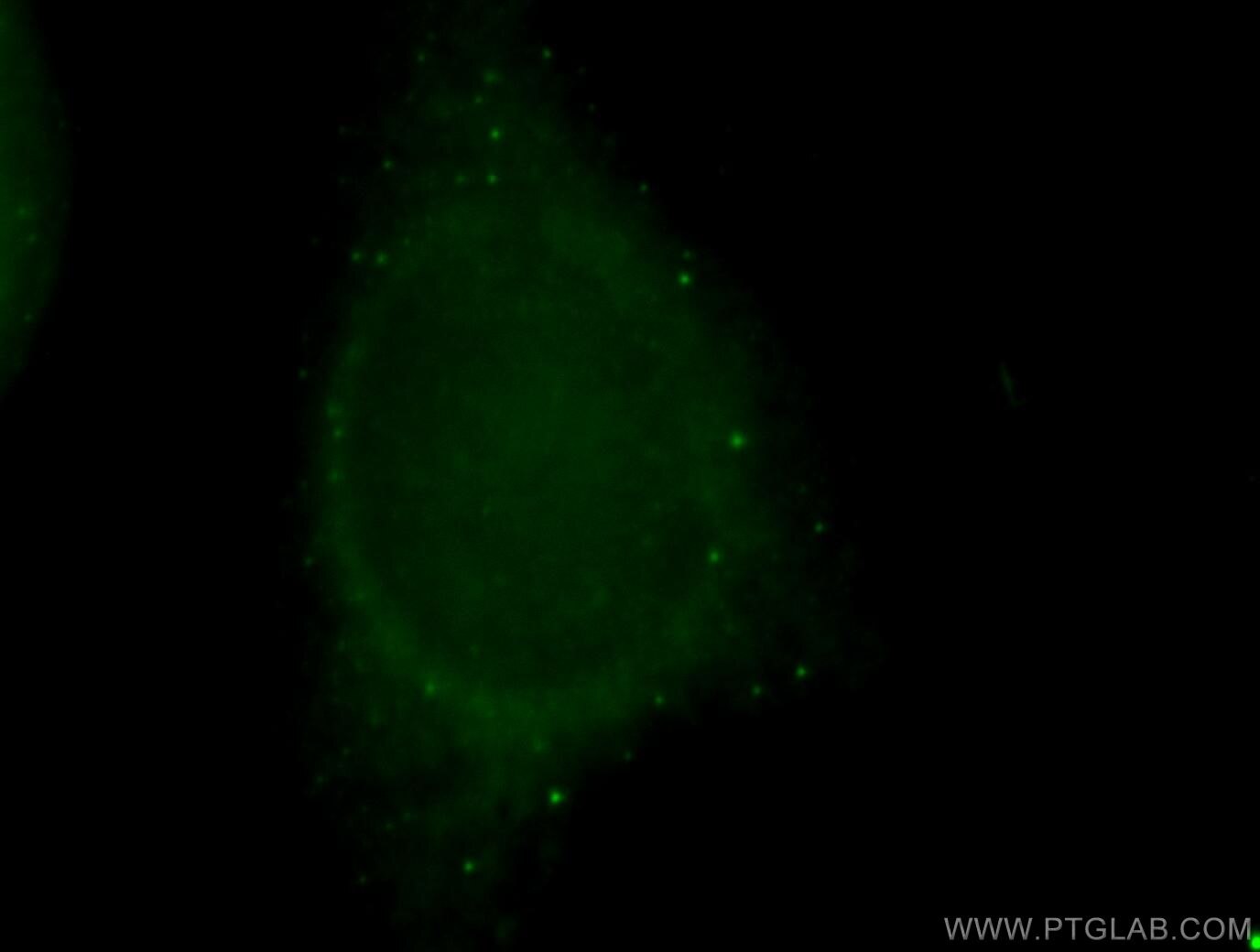 DNA Ligase I