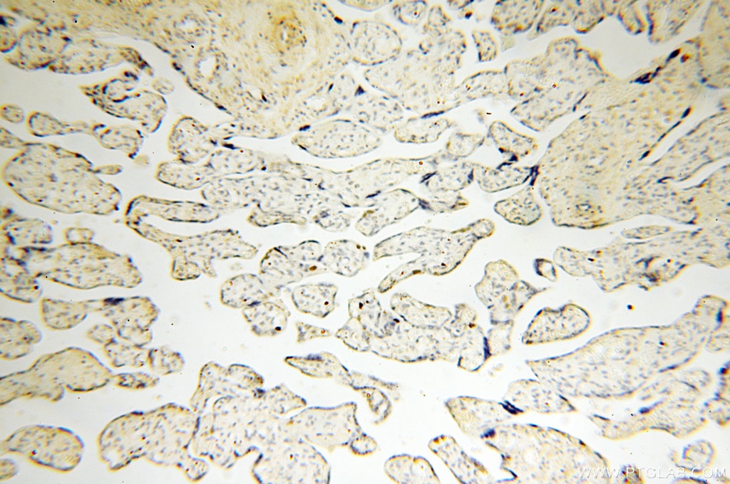 Immunohistochemistry (IHC) staining of human placenta tissue using DNA Ligase I Polyclonal antibody (18051-1-AP)