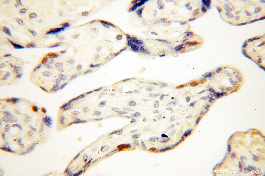 IHC staining of human placenta using 18051-1-AP