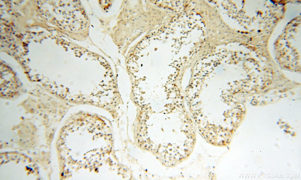 Immunohistochemistry (IHC) staining of human testis tissue using DNA Ligase I Polyclonal antibody (18051-1-AP)