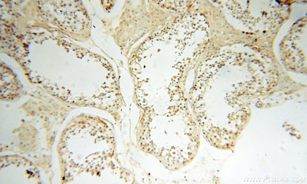 IHC staining of human testis using 18051-1-AP