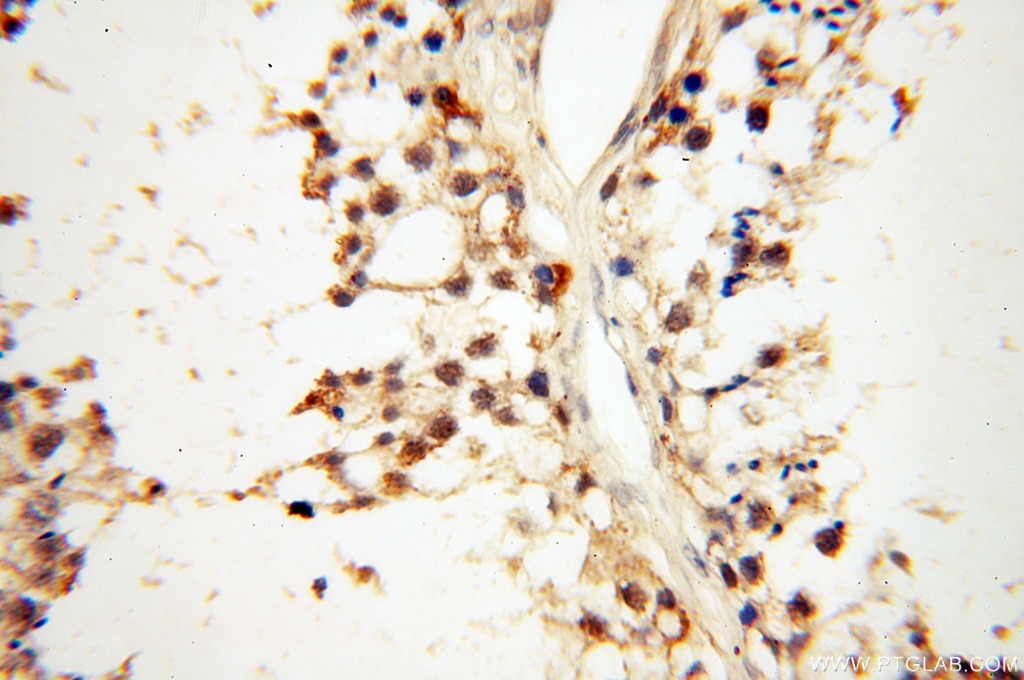 IHC staining of human testis using 18051-1-AP