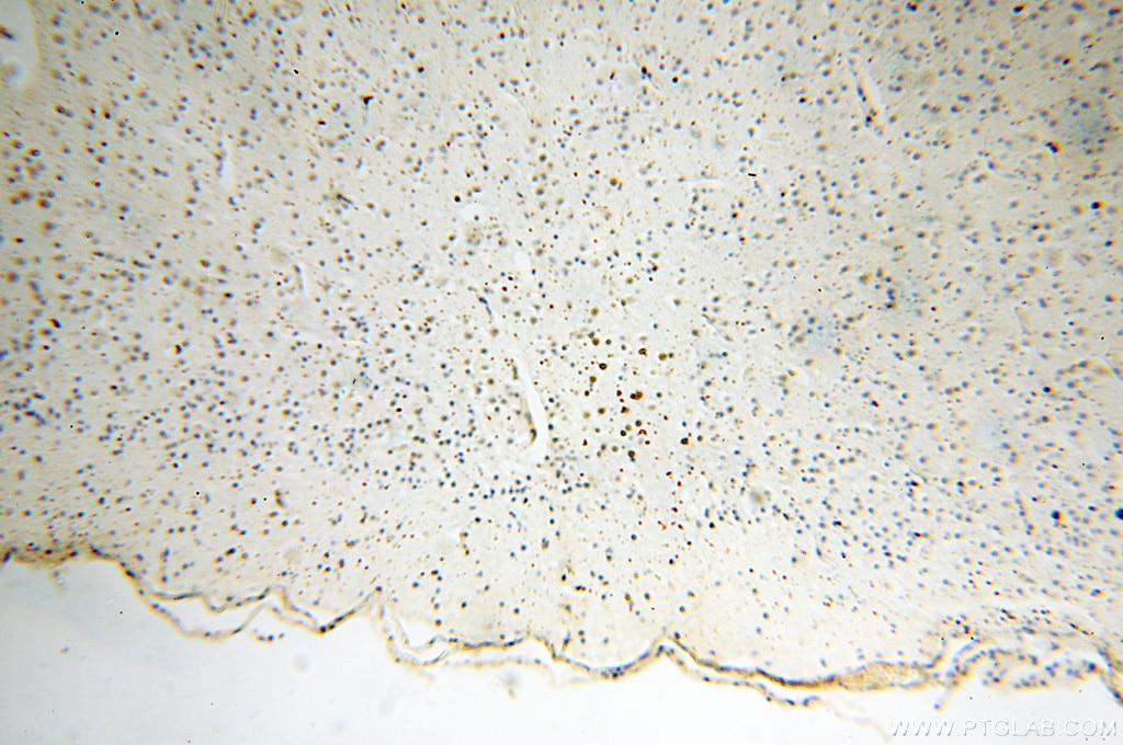 Immunohistochemistry (IHC) staining of human brain tissue using DNA Ligase I Polyclonal antibody (18051-1-AP)