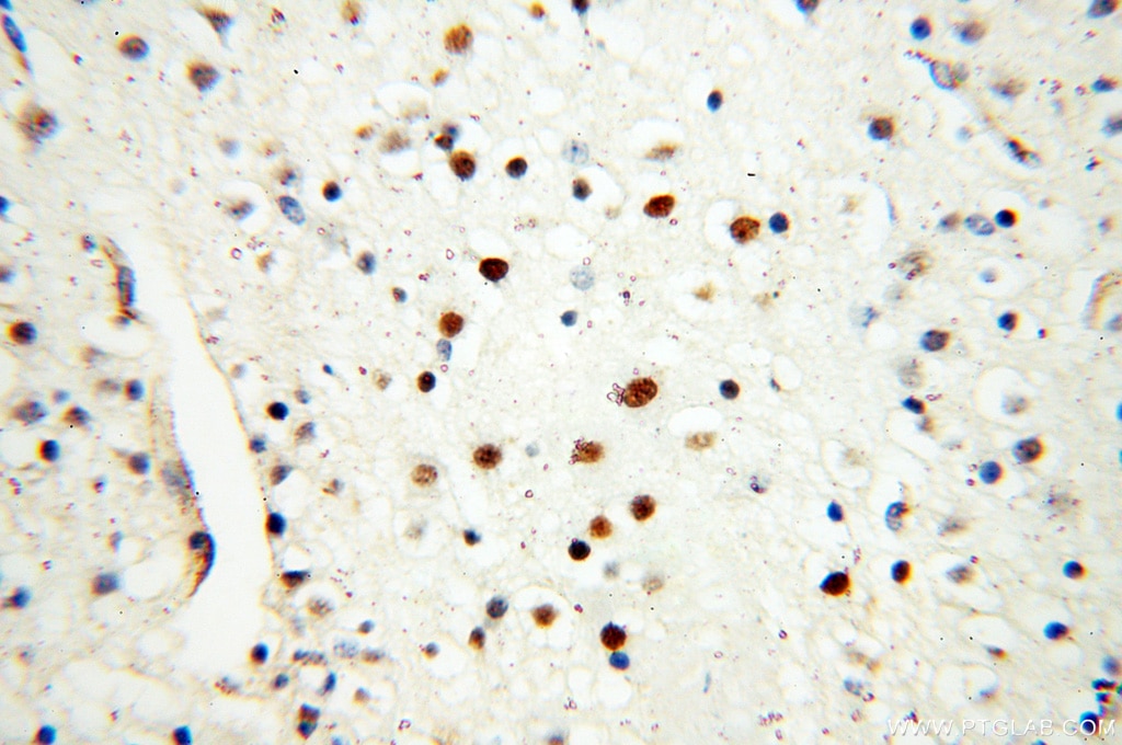 IHC staining of human brain using 18051-1-AP