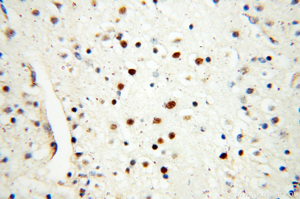 Immunohistochemistry (IHC) staining of human brain tissue using DNA Ligase I Polyclonal antibody (18051-1-AP)