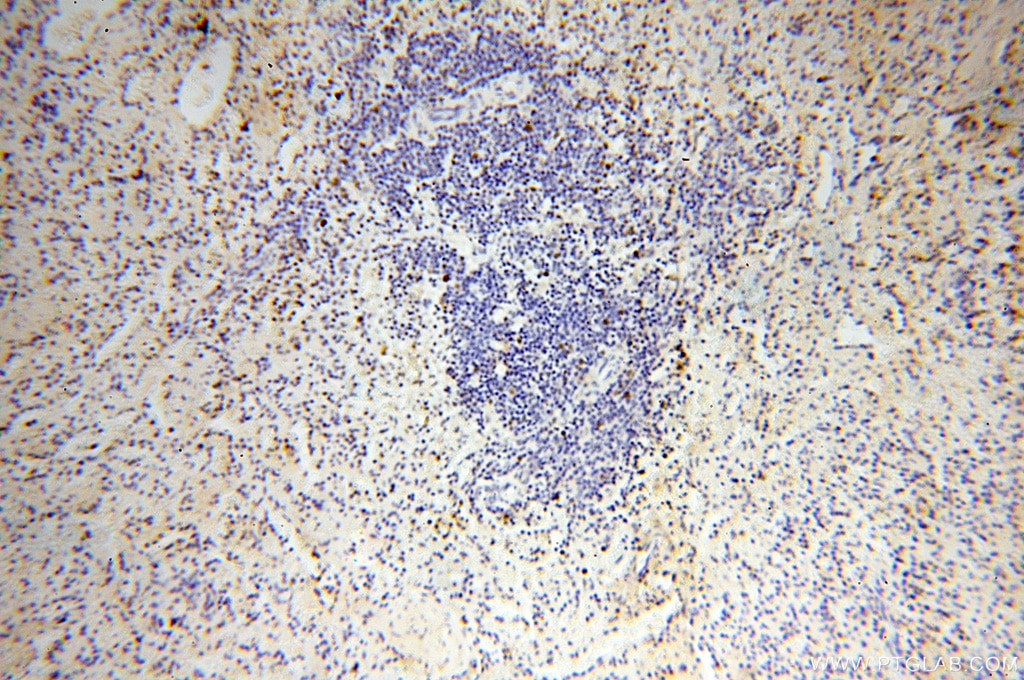 Immunohistochemistry (IHC) staining of human spleen tissue using DNA Ligase I Polyclonal antibody (18051-1-AP)