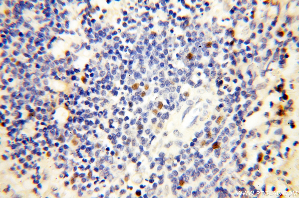 Immunohistochemistry (IHC) staining of human spleen tissue using DNA Ligase I Polyclonal antibody (18051-1-AP)