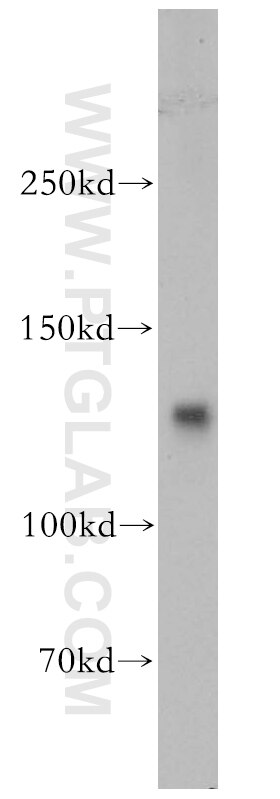 Western Blot (WB) analysis of A431 cells using DNA Ligase I Polyclonal antibody (18051-1-AP)