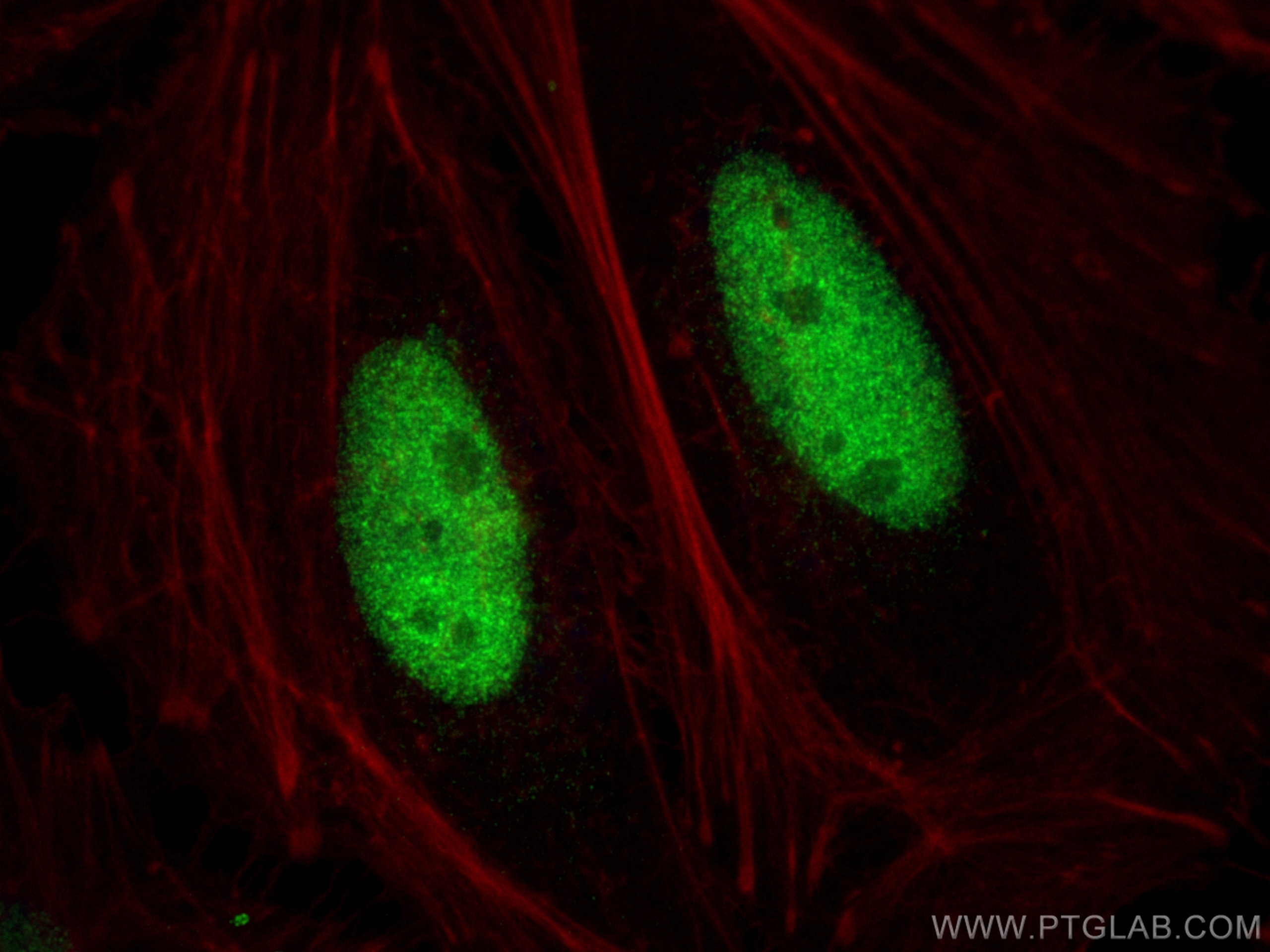 Immunofluorescence (IF) / fluorescent staining of HeLa cells using DNA ligase III/LIG3 Polyclonal antibody (26583-1-AP)