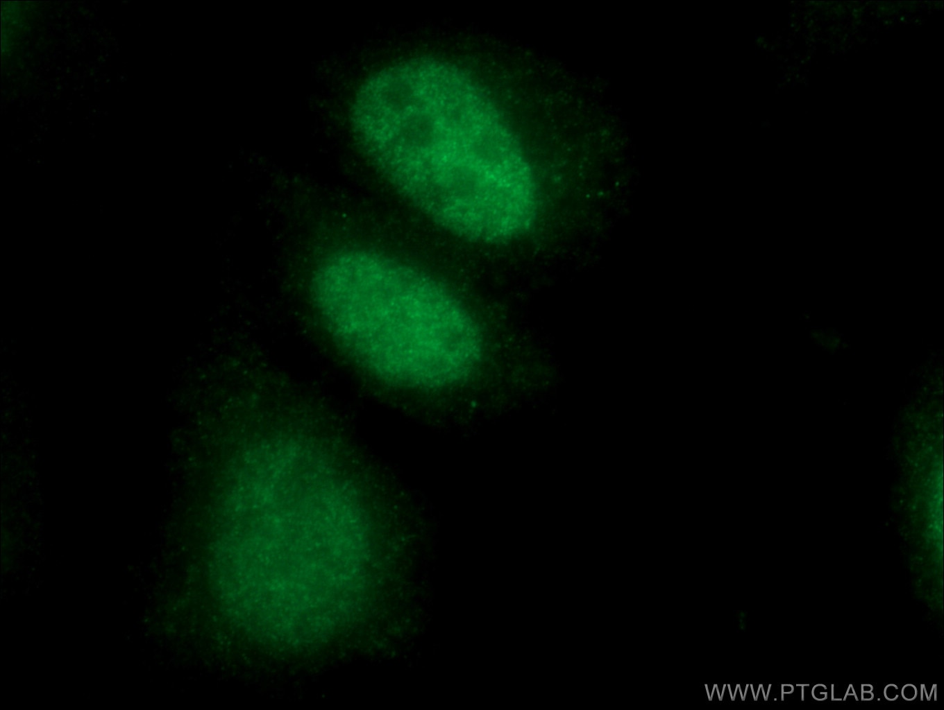 Immunofluorescence (IF) / fluorescent staining of HeLa cells using LIG3 Polyclonal antibody (26583-1-AP)