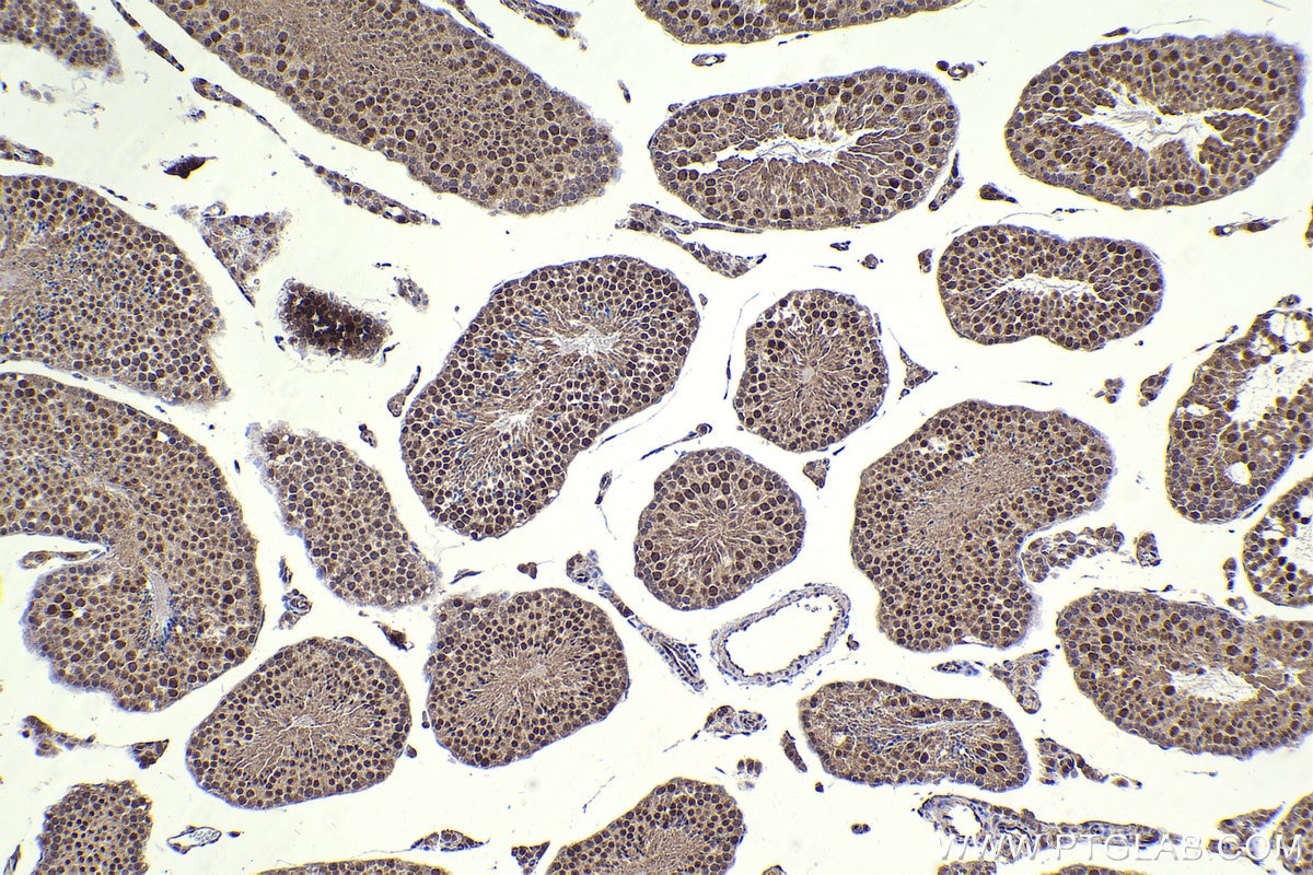 Immunohistochemistry (IHC) staining of mouse testis tissue using DNA ligase III/LIG3 Polyclonal antibody (26583-1-AP)