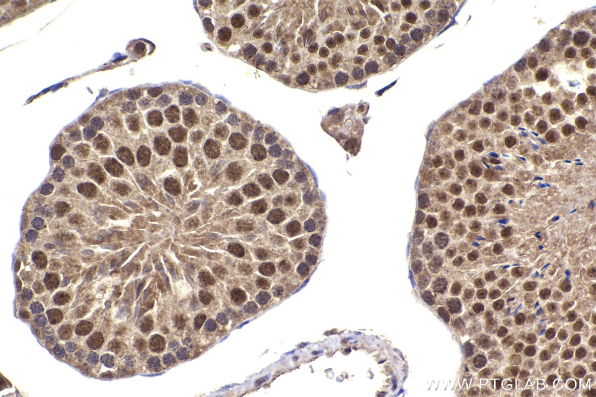 Immunohistochemistry (IHC) staining of mouse testis tissue using DNA ligase III/LIG3 Polyclonal antibody (26583-1-AP)