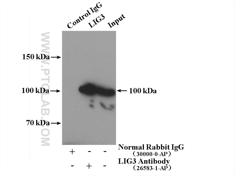 Immunoprecipitation (IP) experiment of HEK-293T cells using DNA ligase III/LIG3 Polyclonal antibody (26583-1-AP)