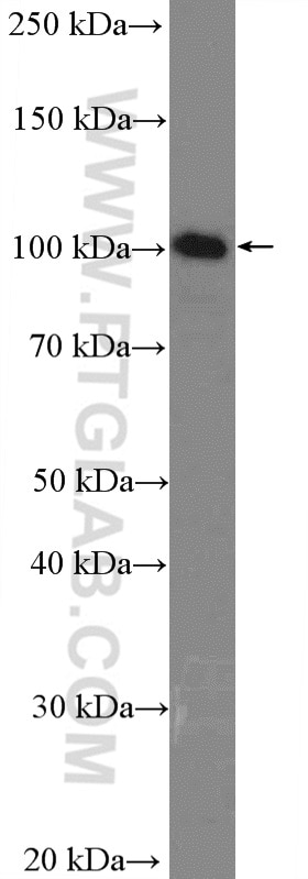 Western Blot (WB) analysis of HEK-293T cells using DNA ligase III/LIG3 Polyclonal antibody (26583-1-AP)