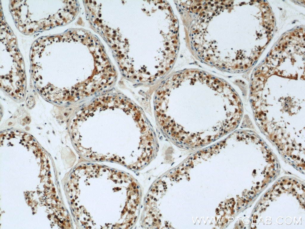 Immunohistochemistry (IHC) staining of human testis tissue using LIG4 Polyclonal antibody (12695-1-AP)