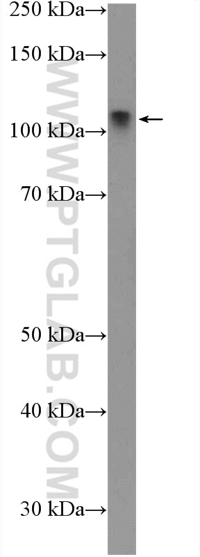 Western Blot (WB) analysis of rat testis tissue using LIG4 Polyclonal antibody (12695-1-AP)