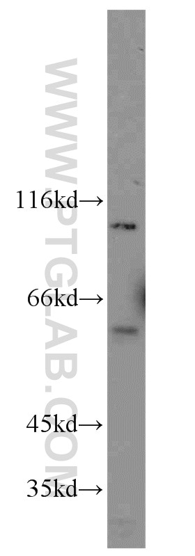 Western Blot (WB) analysis of mouse liver tissue using LIG4 Polyclonal antibody (12695-1-AP)
