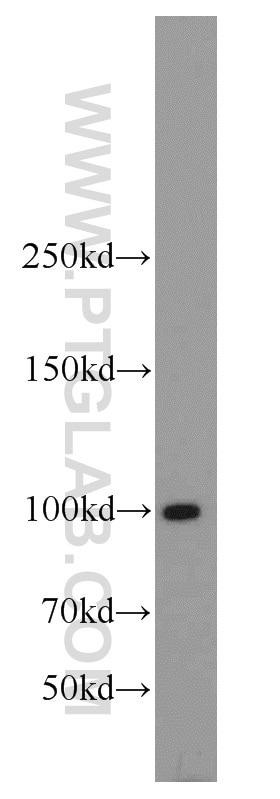 Western Blot (WB) analysis of mouse testis tissue using LIG4 Polyclonal antibody (12695-1-AP)