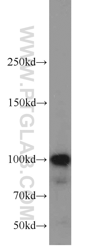 Western Blot (WB) analysis of HepG2 cells using LIG4 Polyclonal antibody (12695-1-AP)