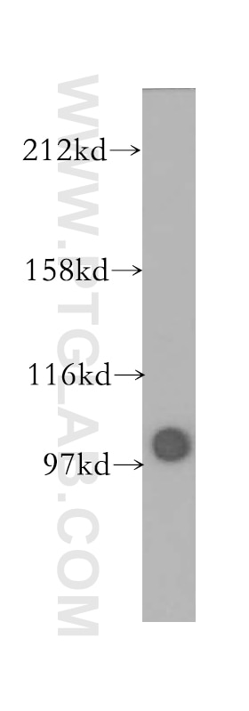 Western Blot (WB) analysis of HeLa cells using LIG4 Polyclonal antibody (12695-1-AP)