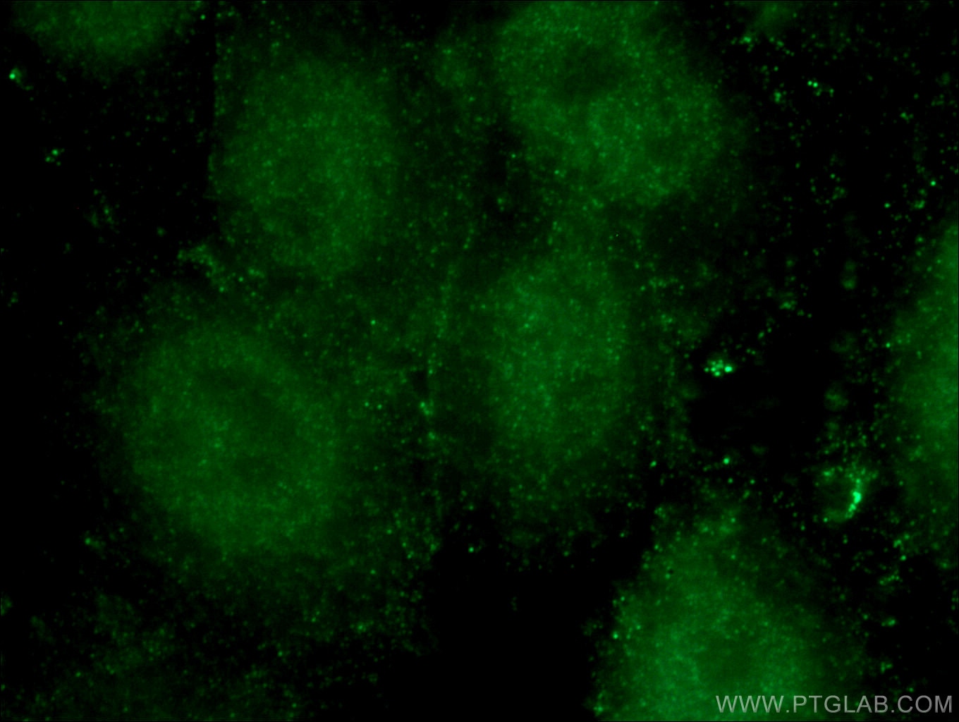 Immunofluorescence (IF) / fluorescent staining of HepG2 cells using LIG4 Monoclonal antibody (66705-1-Ig)
