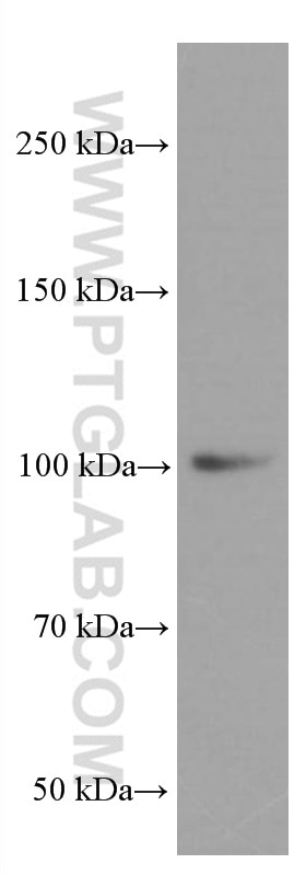 Western Blot (WB) analysis of human testis tissue using LIG4 Monoclonal antibody (66705-1-Ig)