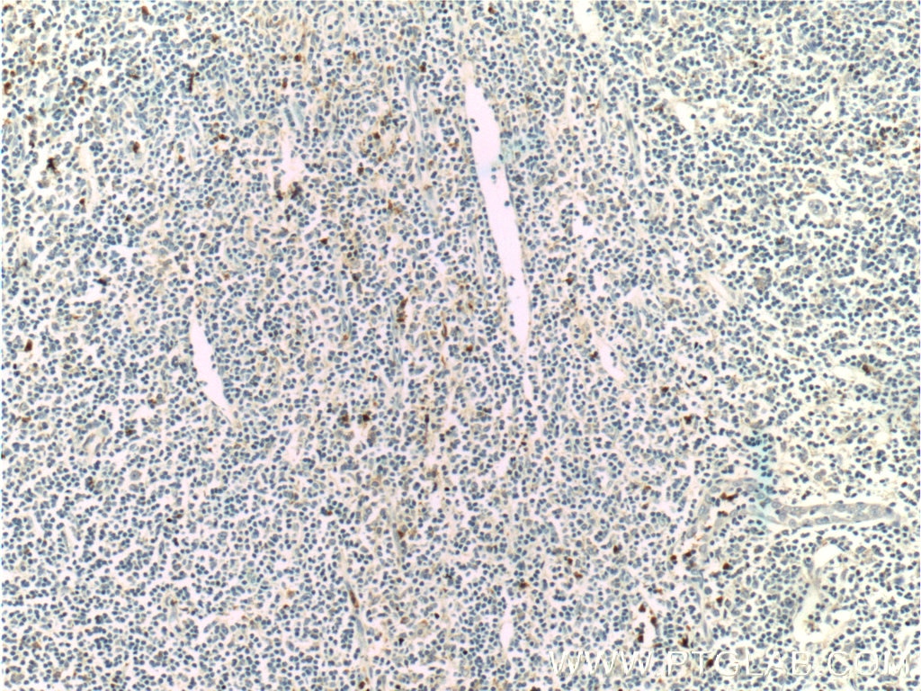 Immunohistochemistry (IHC) staining of human tonsillitis tissue using LILRA2 Polyclonal antibody (11461-1-AP)