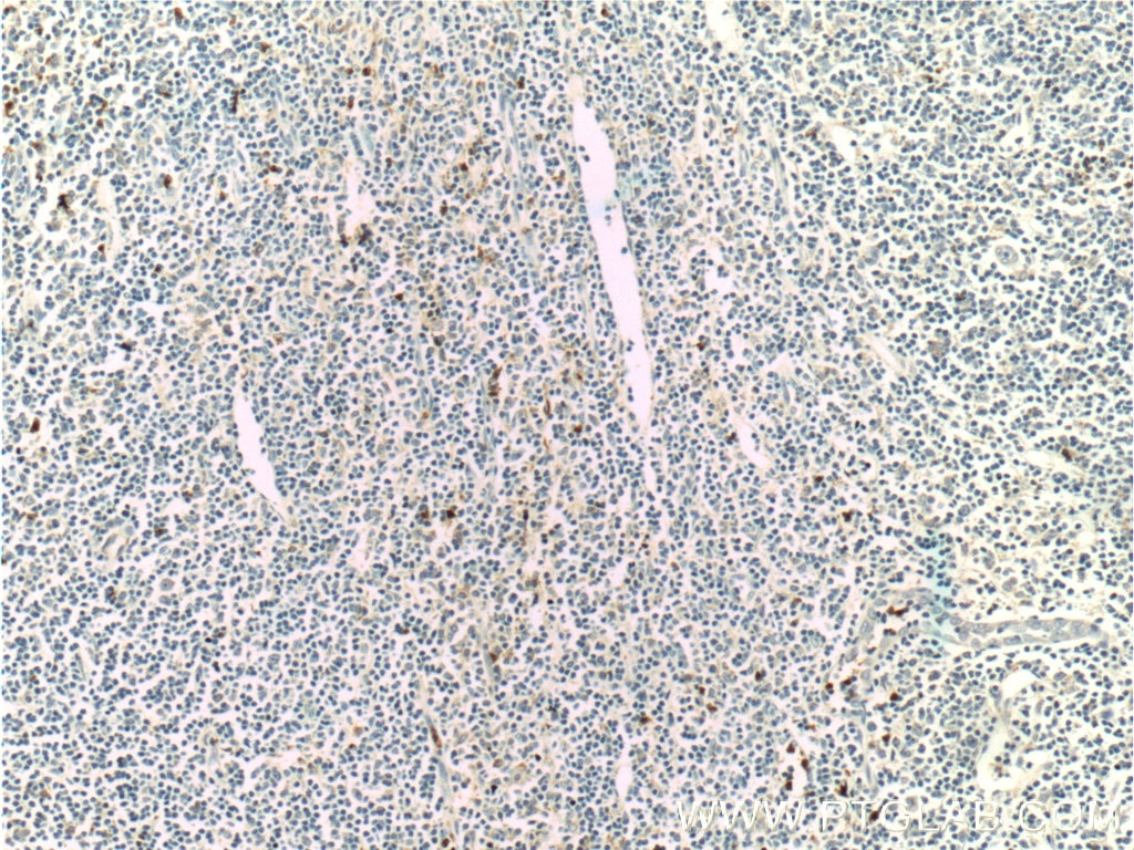 IHC staining of human tonsillitis using 11461-1-AP