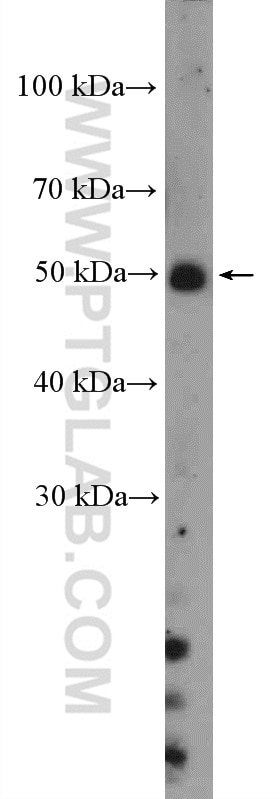 Western Blot (WB) analysis of pig spleen tissue using LILRA2 Polyclonal antibody (11461-1-AP)