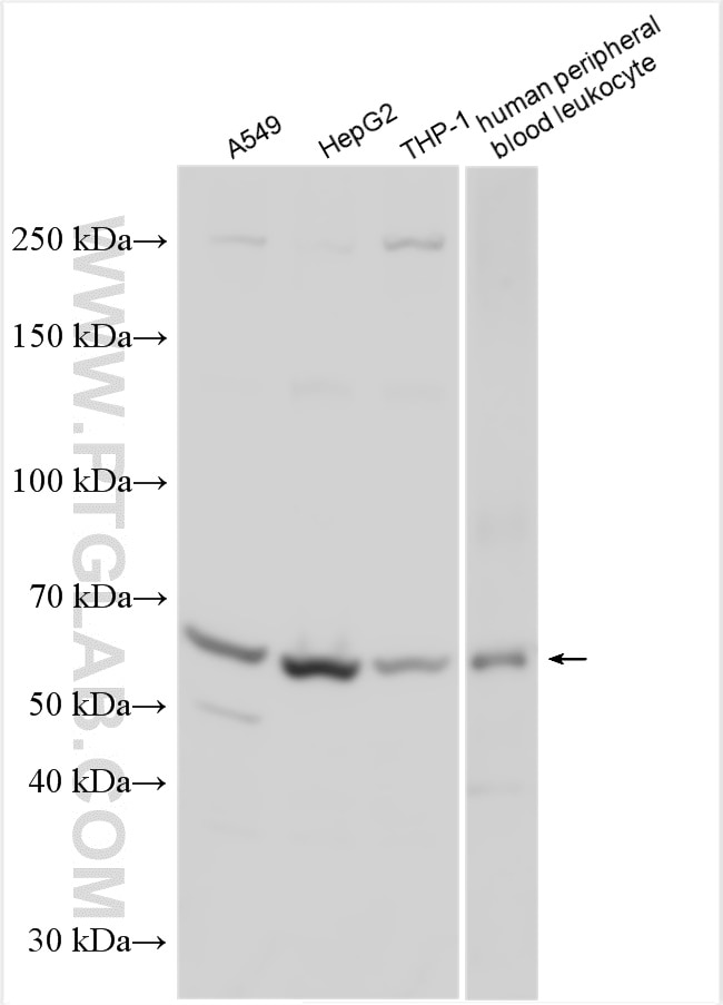 Western Blot (WB) analysis of various lysates using LILRA2 Polyclonal antibody (11461-1-AP)