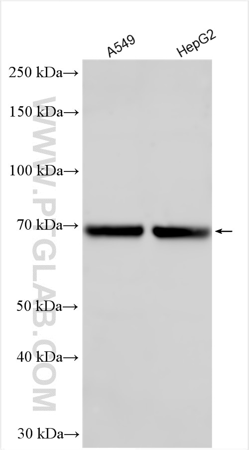 Western Blot (WB) analysis of various lysates using LILRA2 Polyclonal antibody (30285-1-AP)