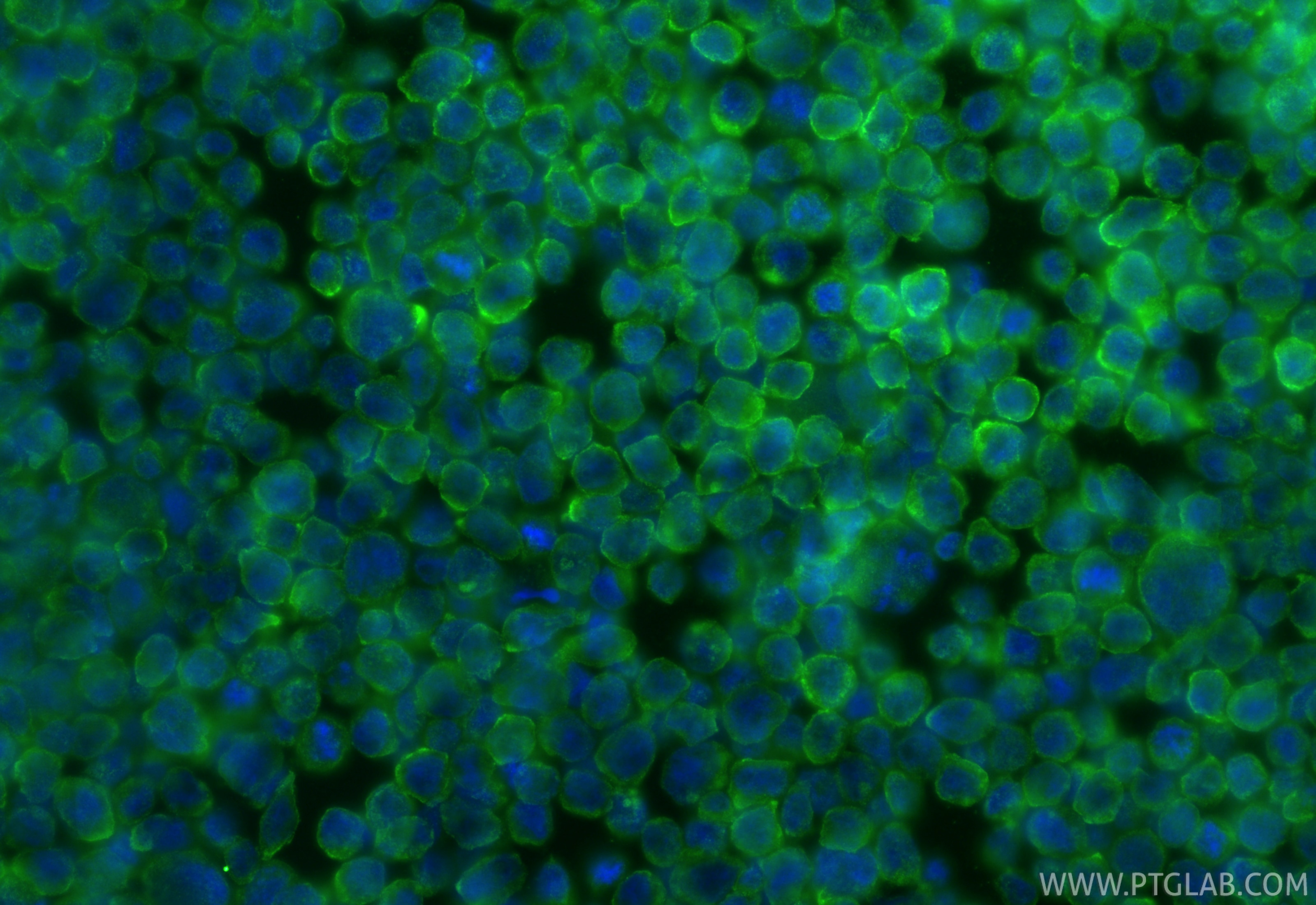 Immunofluorescence (IF) / fluorescent staining of HL-60 cells using LILRA4 Polyclonal antibody (21153-1-AP)