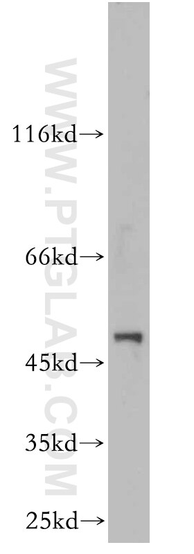 Western Blot (WB) analysis of L02 cells using LILRA4 Polyclonal antibody (21153-1-AP)