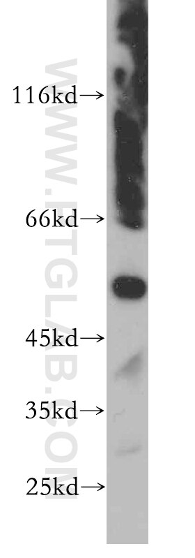 Western Blot (WB) analysis of mouse spleen tissue using LILRA4 Polyclonal antibody (21153-1-AP)