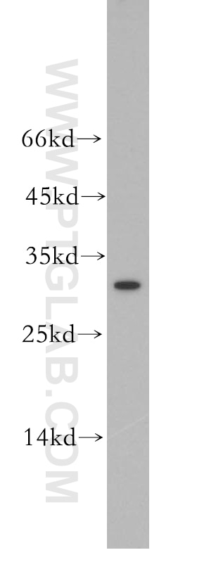 WB analysis of K-562 using 18821-1-AP