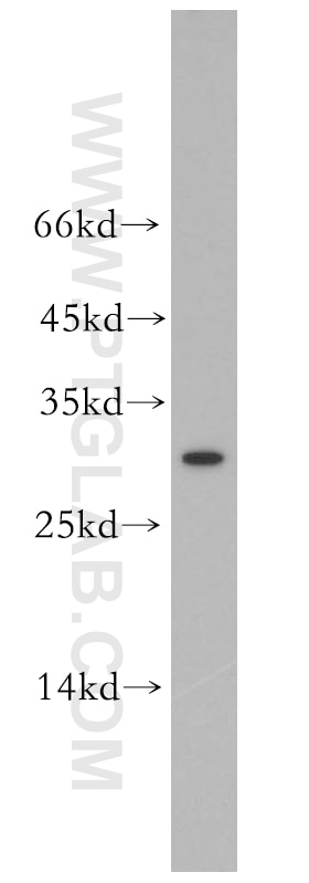 WB analysis of K-562 using 18821-1-AP