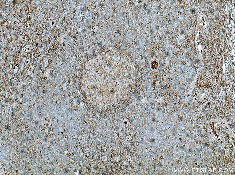 Immunohistochemistry (IHC) staining of human tonsillitis tissue using LILRB1 Polyclonal antibody (26455-1-AP)