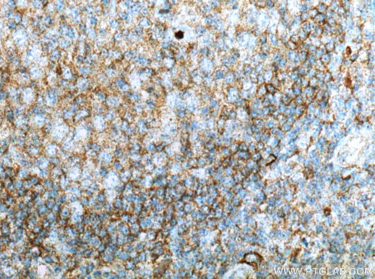 Immunohistochemistry (IHC) staining of human tonsillitis tissue using LILRB1 Polyclonal antibody (26455-1-AP)