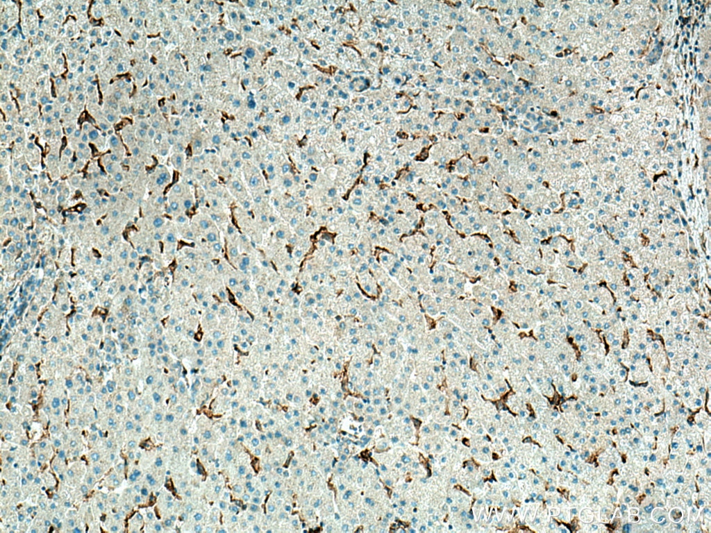 Immunohistochemistry (IHC) staining of human liver tissue using LILRB1 Polyclonal antibody (26455-1-AP)