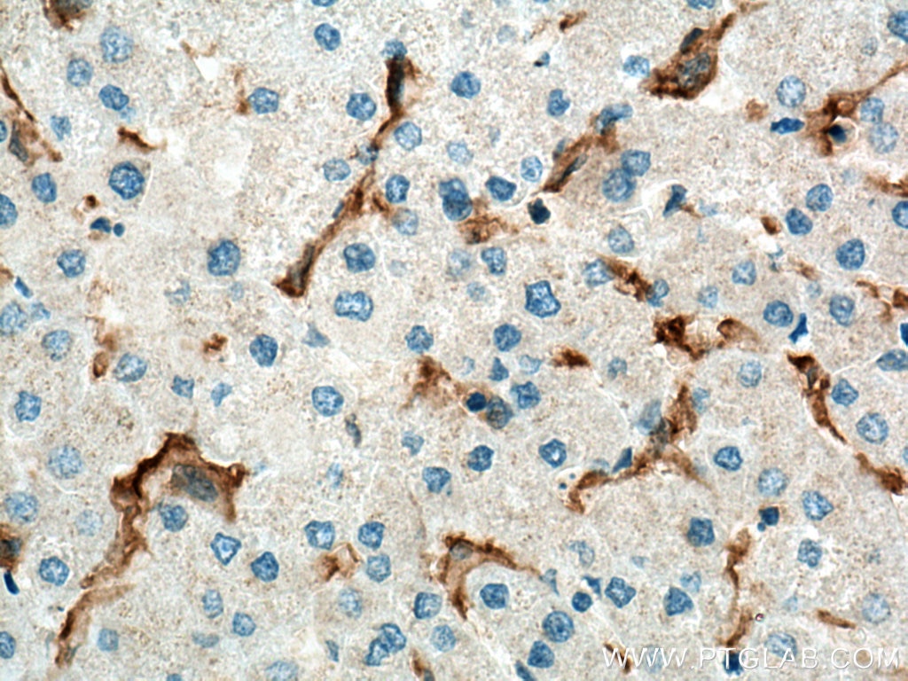 Immunohistochemistry (IHC) staining of human liver tissue using LILRB1 Polyclonal antibody (26455-1-AP)