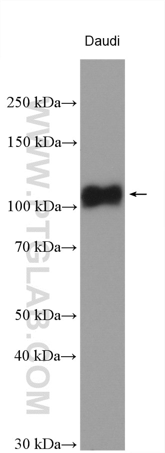 Western Blot (WB) analysis of various lysates using LILRB1 Polyclonal antibody (26455-1-AP)