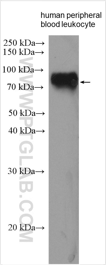Western Blot (WB) analysis of various lysates using LILRB3 Polyclonal antibody (18260-1-AP)