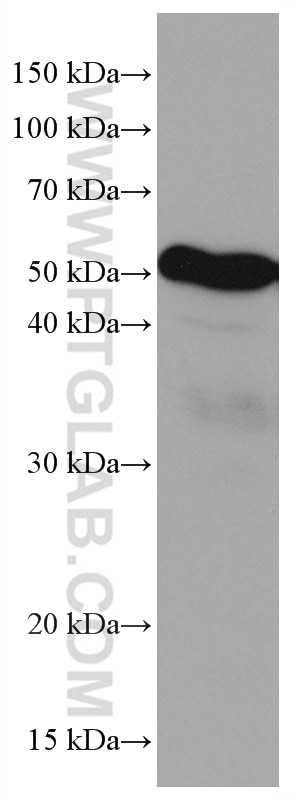 WB analysis of MCF-7 using 67119-1-Ig