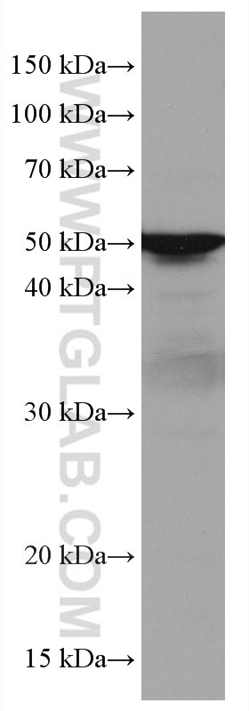 Western Blot (WB) analysis of A549 cells using LILRB4 Monoclonal antibody (67119-1-Ig)