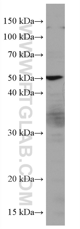 Western Blot (WB) analysis of HUVEC cells using LILRB4 Monoclonal antibody (67119-1-Ig)