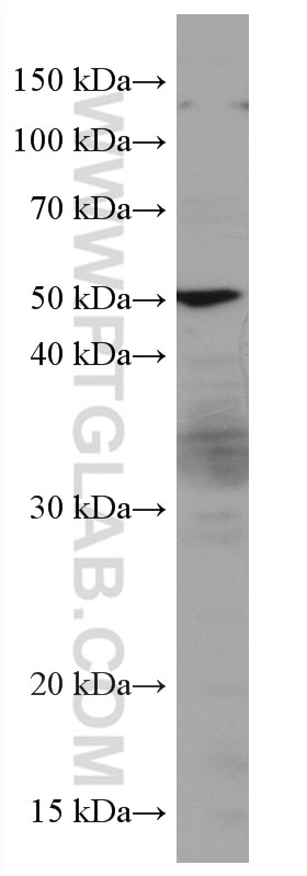 WB analysis of HUVEC using 67119-1-Ig