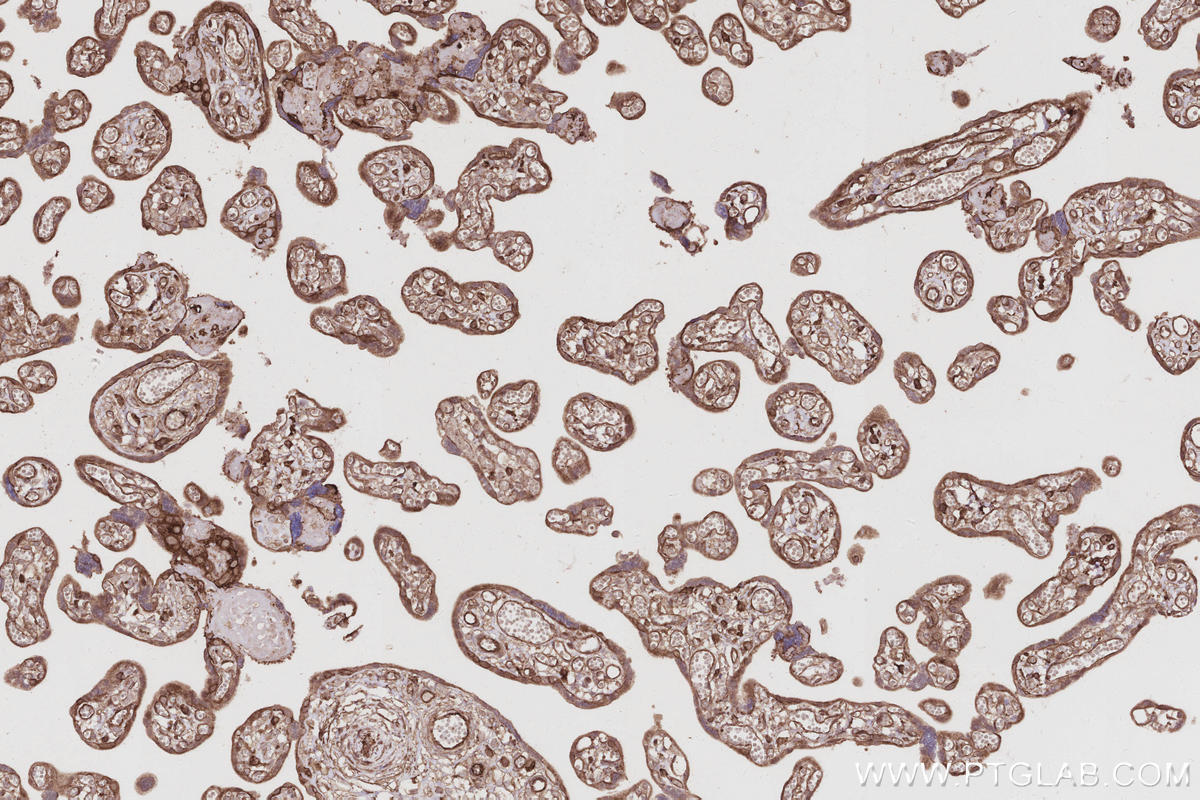 Immunohistochemistry (IHC) staining of human placenta tissue using EPLIN Polyclonal antibody (16639-1-AP)