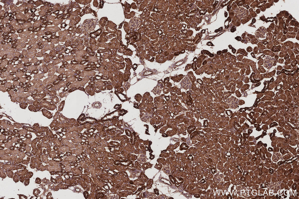 Immunohistochemistry (IHC) staining of mouse kidney tissue using EPLIN Polyclonal antibody (16639-1-AP)